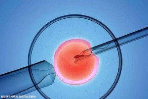 正规拉拉供卵代孕咨询